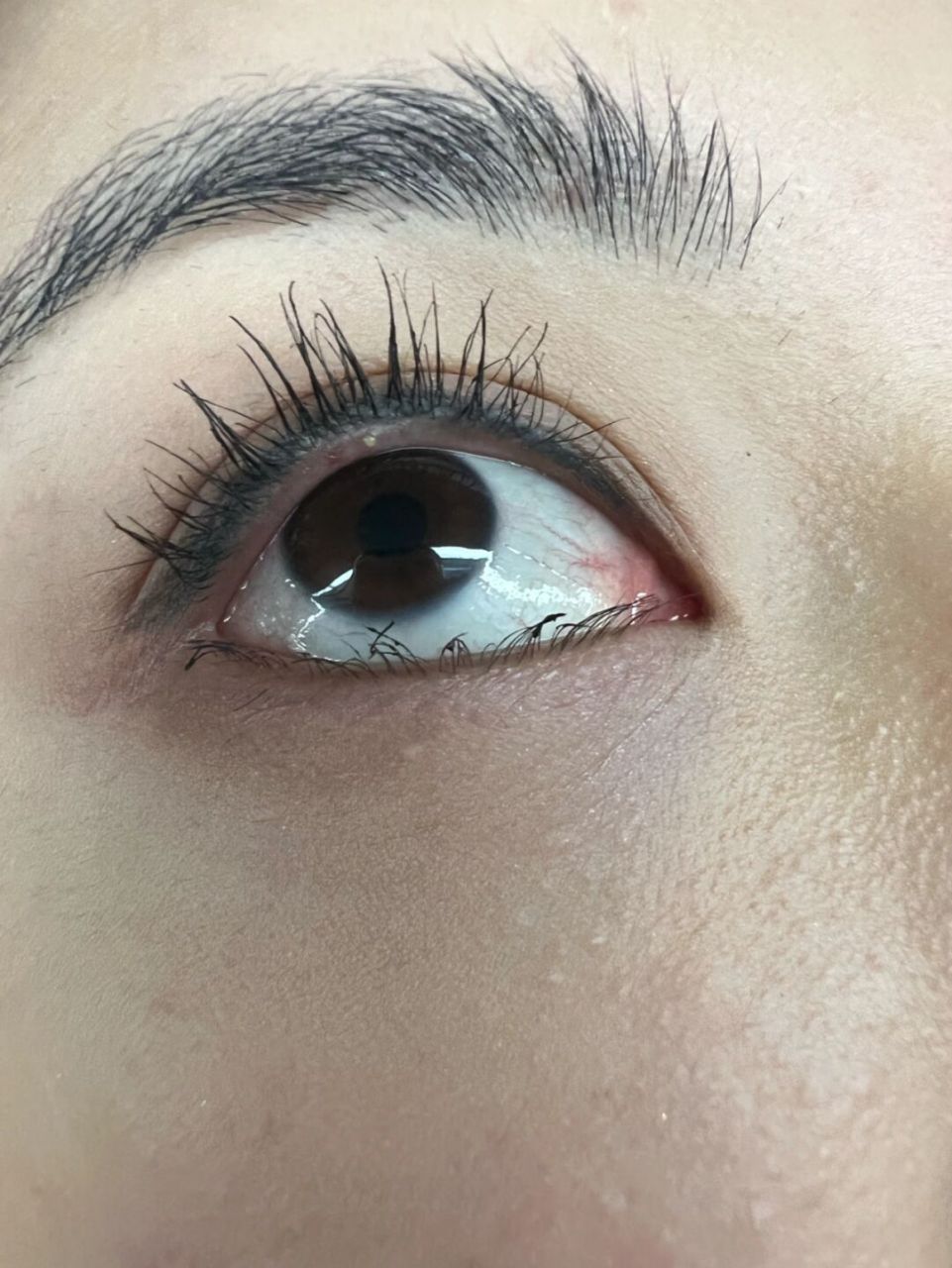 今天画睫毛发现眼珠上面,上眼睑有个白脂肪粒一样的东西,这是啥?