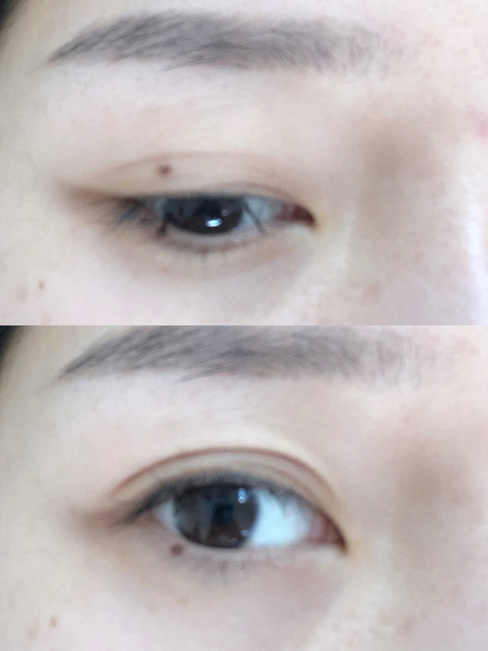 眼皮上下都有痣什么意思?