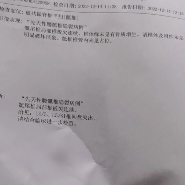 关于先天性骶骨隐裂想问问大家