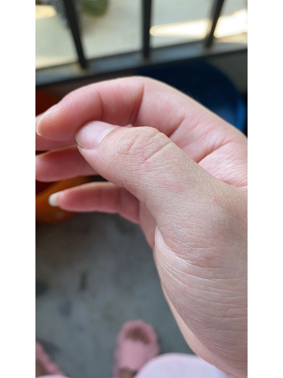 狗狗咬了没破皮没流血要不要打针啊 早上给狗狗剪毛不小心被家里狗狗