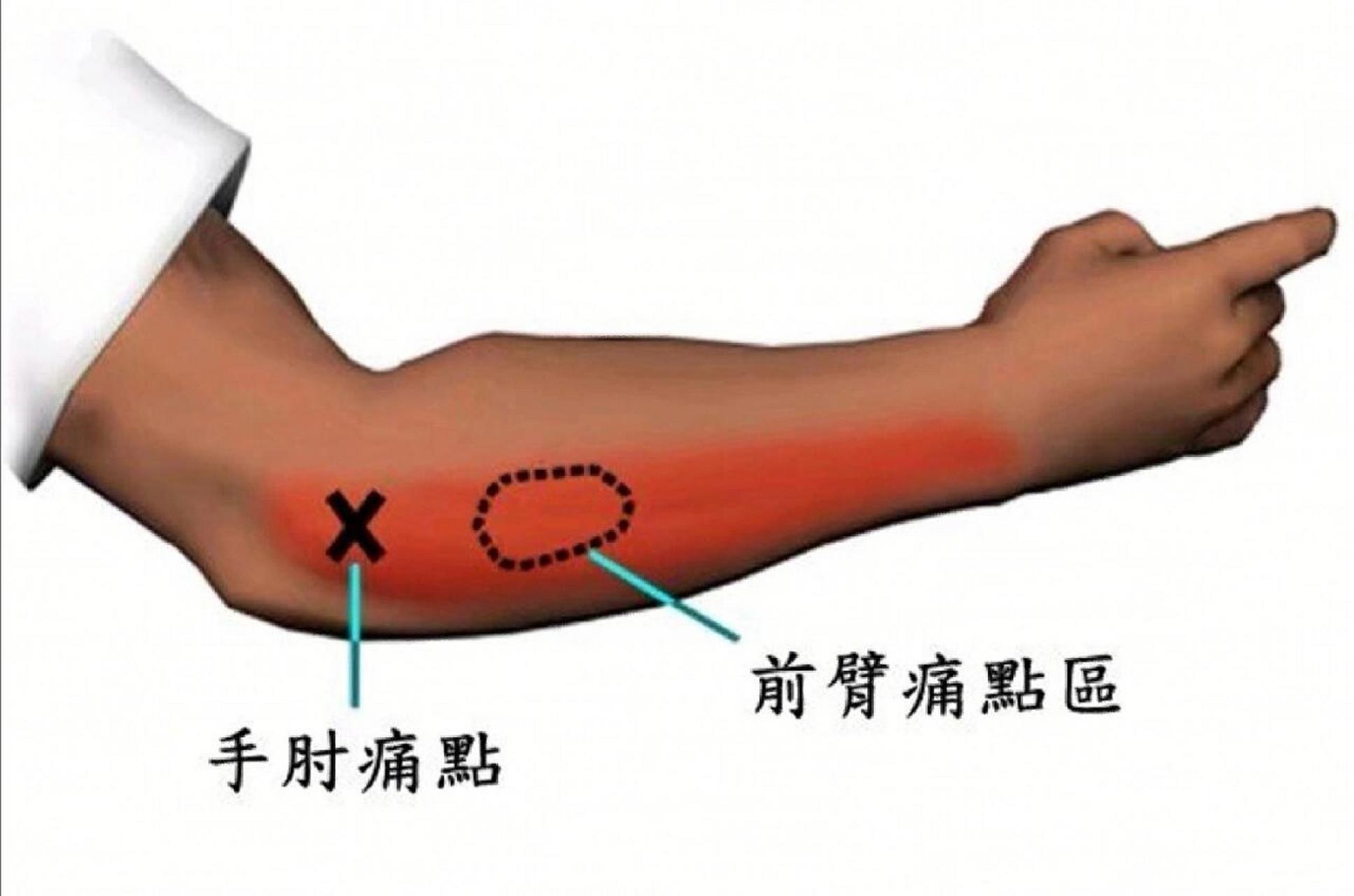 人体肘部哪个位置图图片