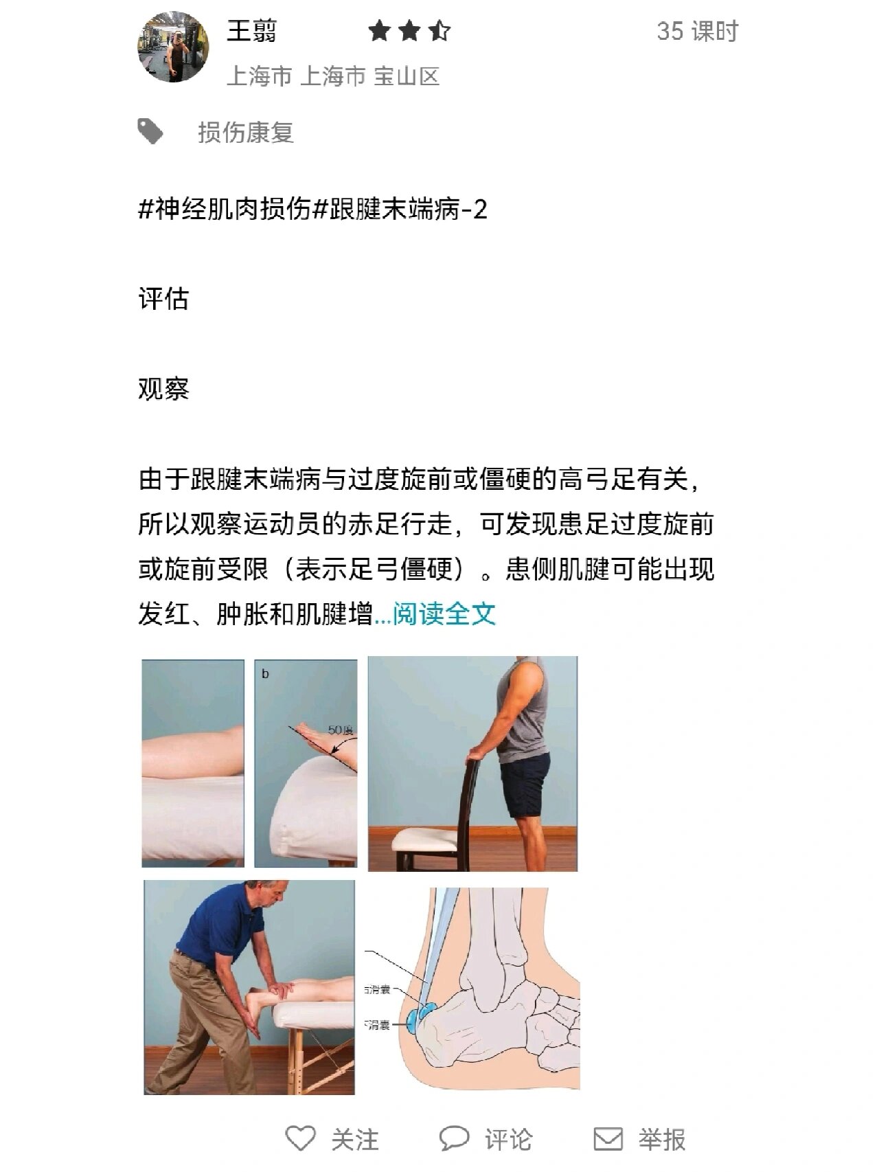 跟腱末端病图片