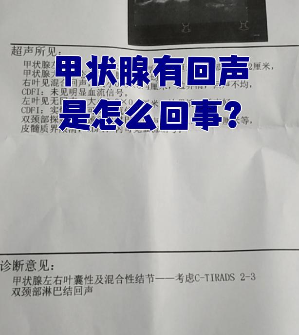在山谷里喊一声为什么有回声百科在线 在山谷里喊一声为什么有回声百科在线