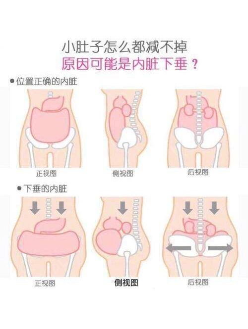 心疼产后妈妈李靓蕾 | 产后内脏下垂分享 73李靓蕾:感觉生完二宝