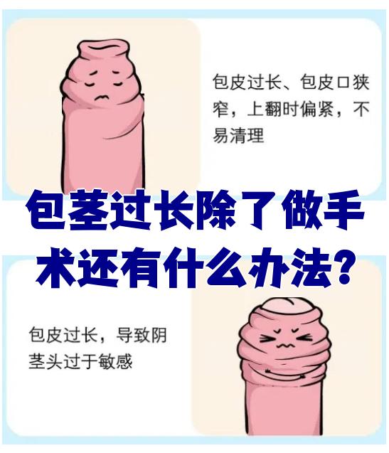 包茎过长除了做手术还有什么办法?