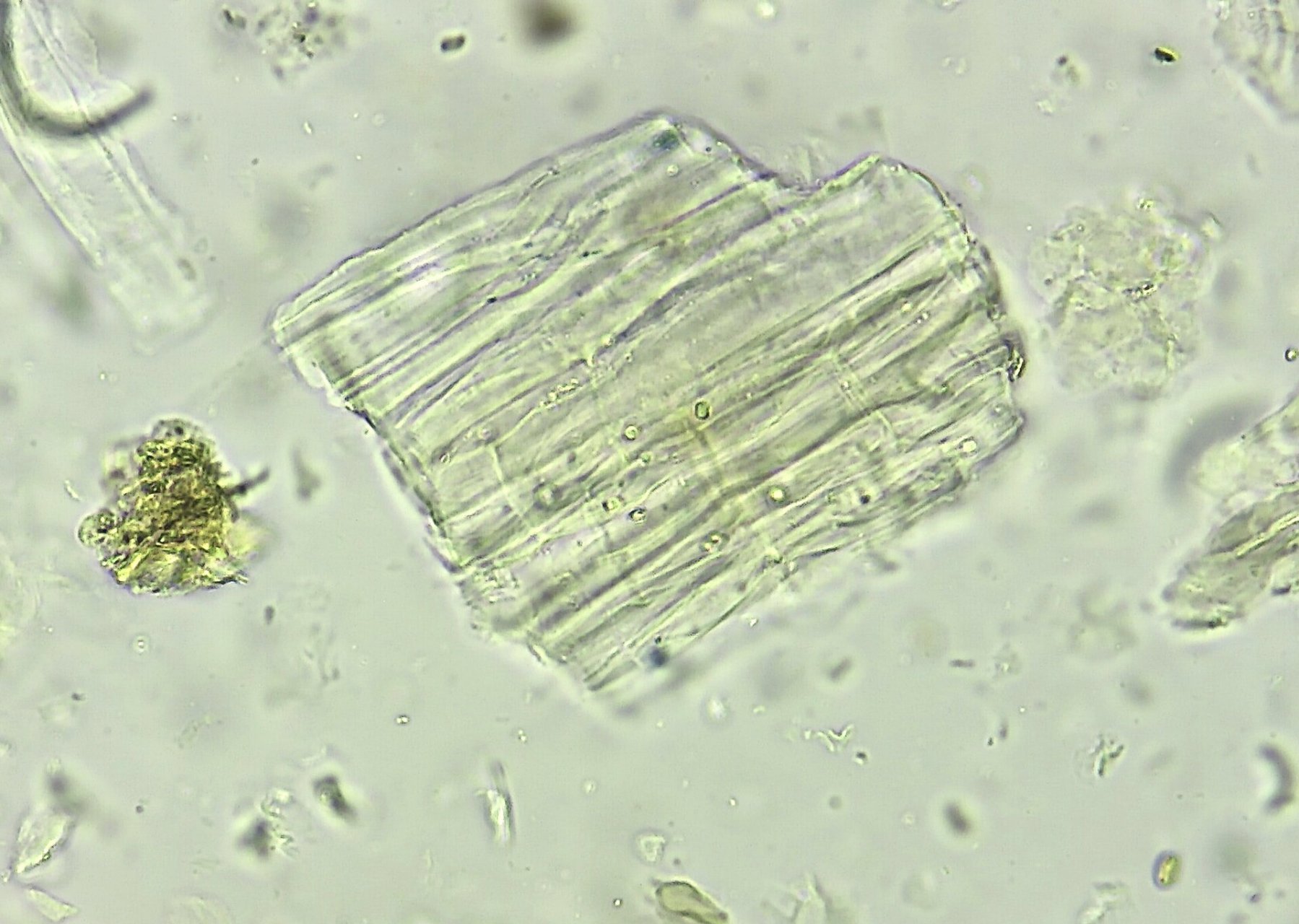 翻一翻以前的做的粉末显微鉴定-大青叶 大青叶来源于十字花科植物菘蓝