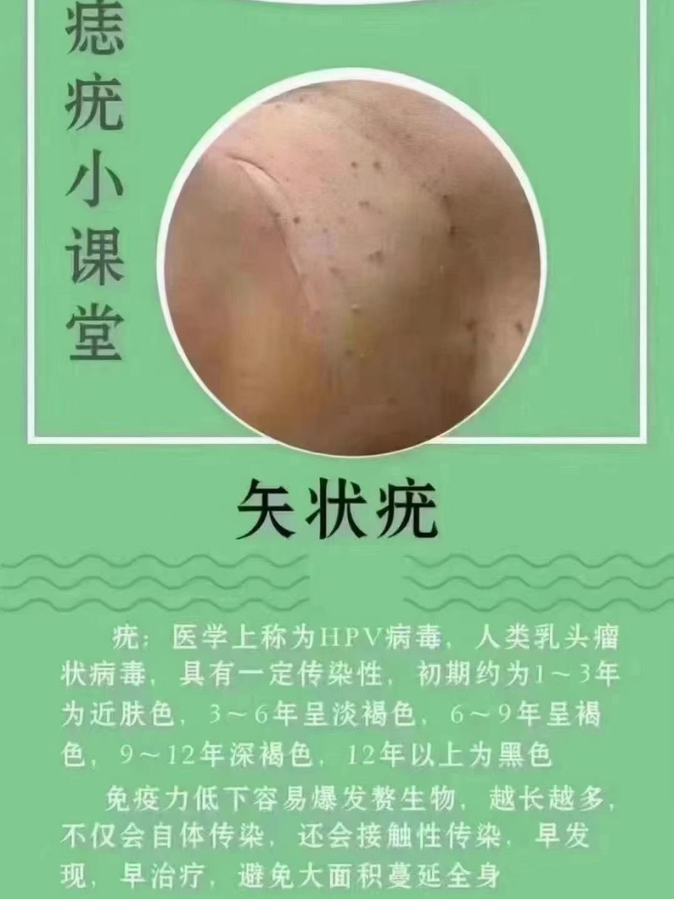 痣,疣小课堂,统统解决