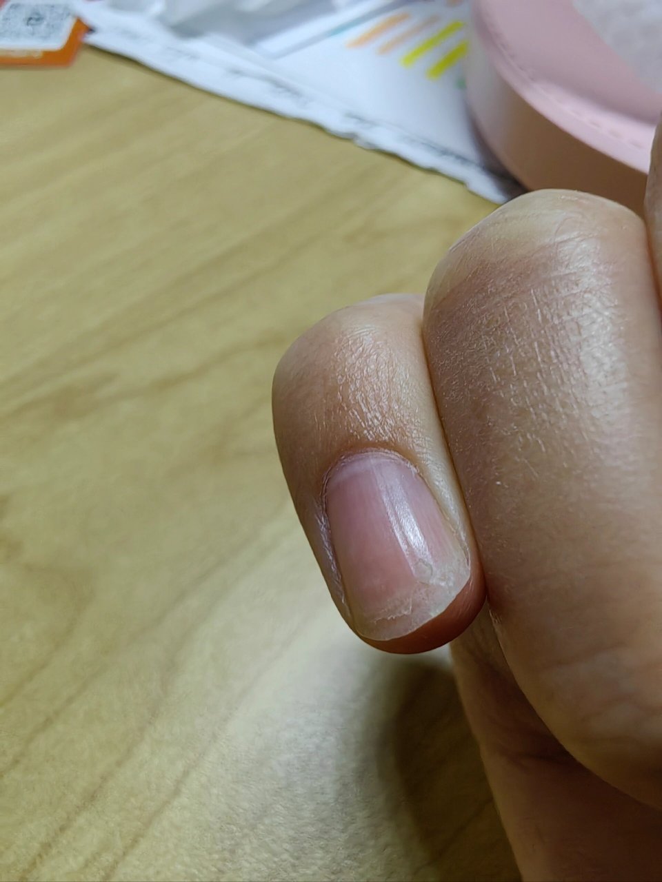 为什么指甲老是分层裂开啊 好头疼,长到一定程度就好像要脱一层衣服一