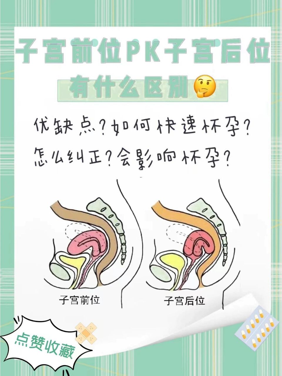 子宫前位&子宫后位哪个更容易怀孕呢04 子宫前位真的容易怀孕吗?