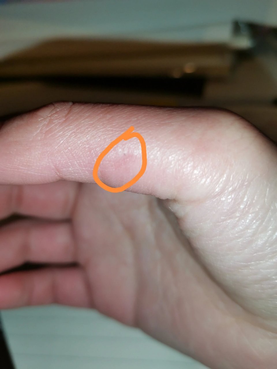 手上扎个刺 别看小 太疼了 在奶奶家 很好奇的拿了一下竹子馍框