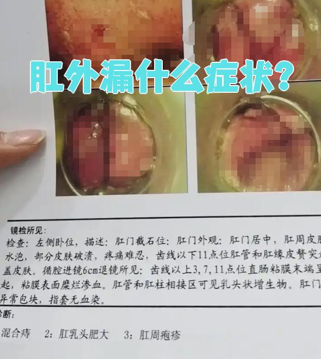 的症状会根据原发病不同而有区别