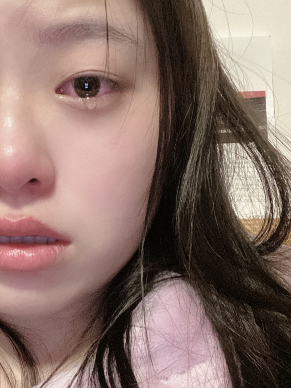 【哭的眼睛肿泡了】第二天如何自救出门 普通人里的普通事 前一天晚上