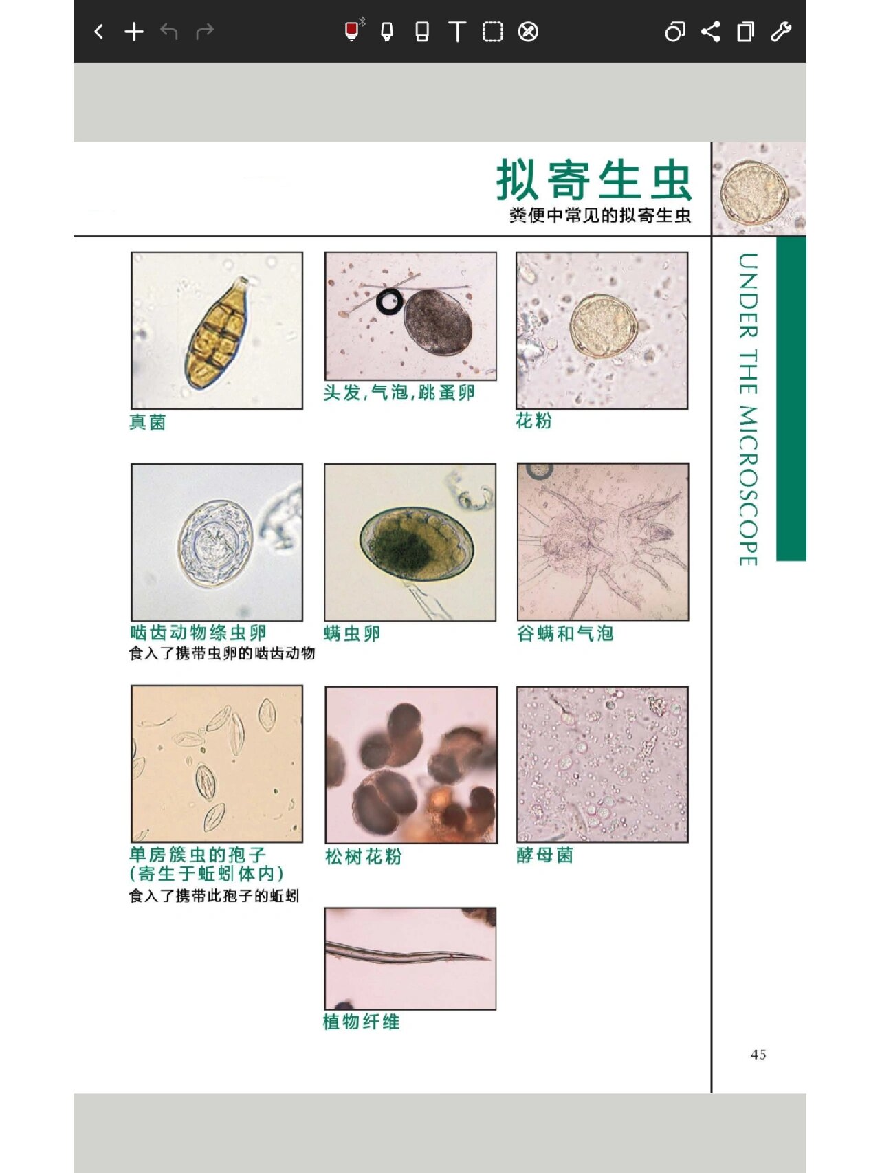 弓形虫多大图片