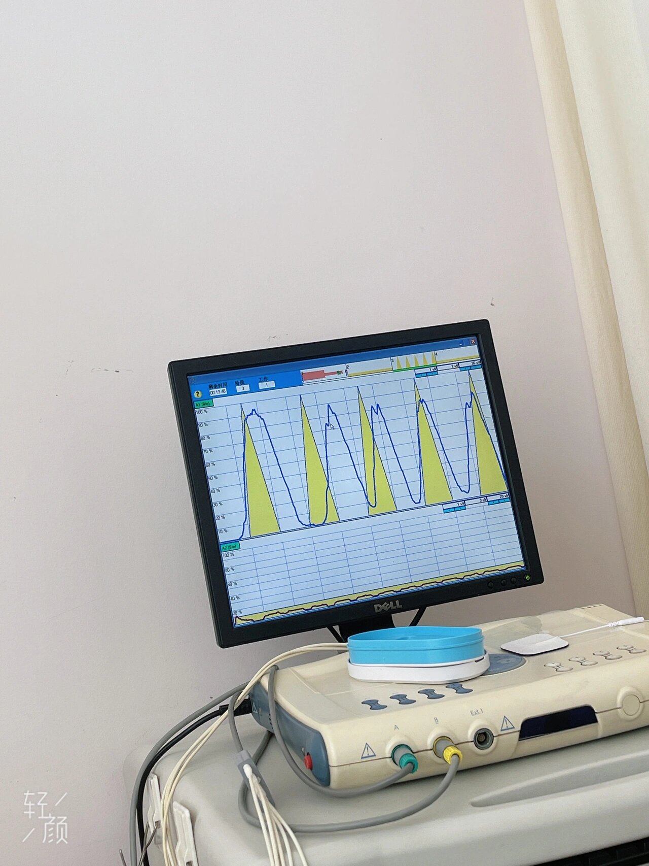 盆底肌修复膀胱脱垂 盆底肌第八次了,图形对我来说难,上不去肌力就是