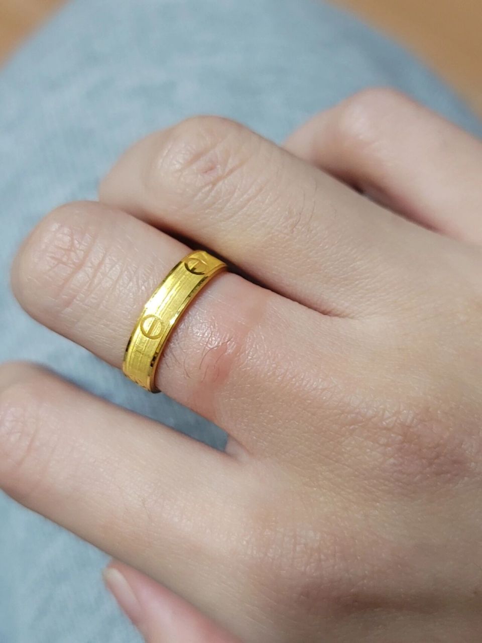 这是对金过敏吗 新买的金戒指才戴了几天,今天感觉戴戒指的地方有点痒
