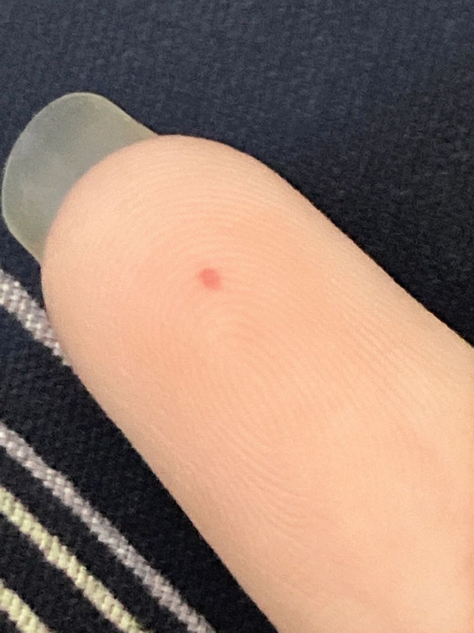 第二种:以前老人说 如果经历三关 六劫 九难以后手上长出朱砂痣
