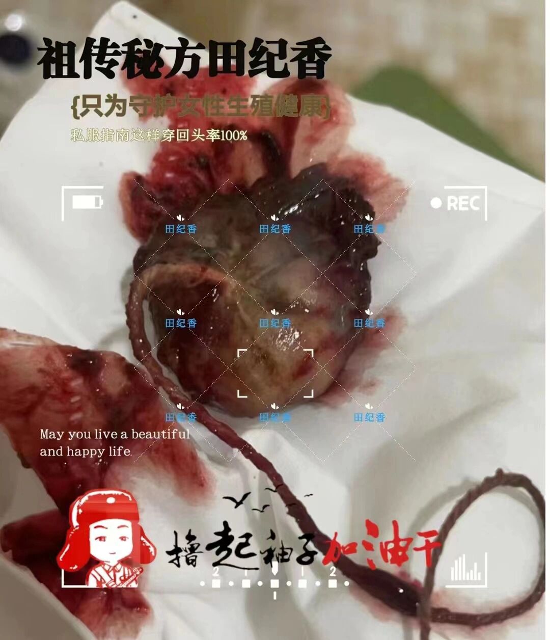 ①久治不愈的问题康复 ②皮肤问题得以改善 ③远离妇科问题的困扰
