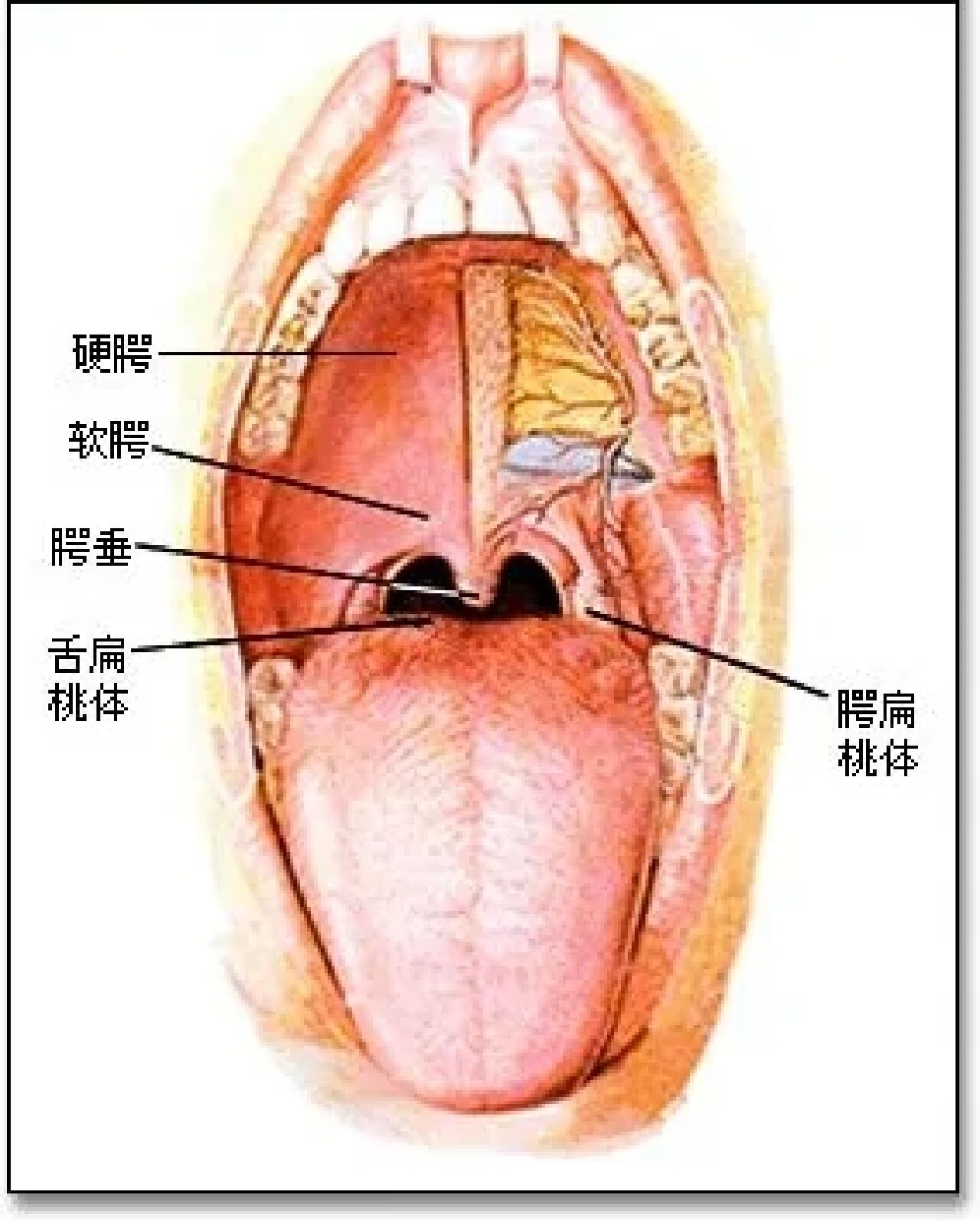 喉咙悬垂图片