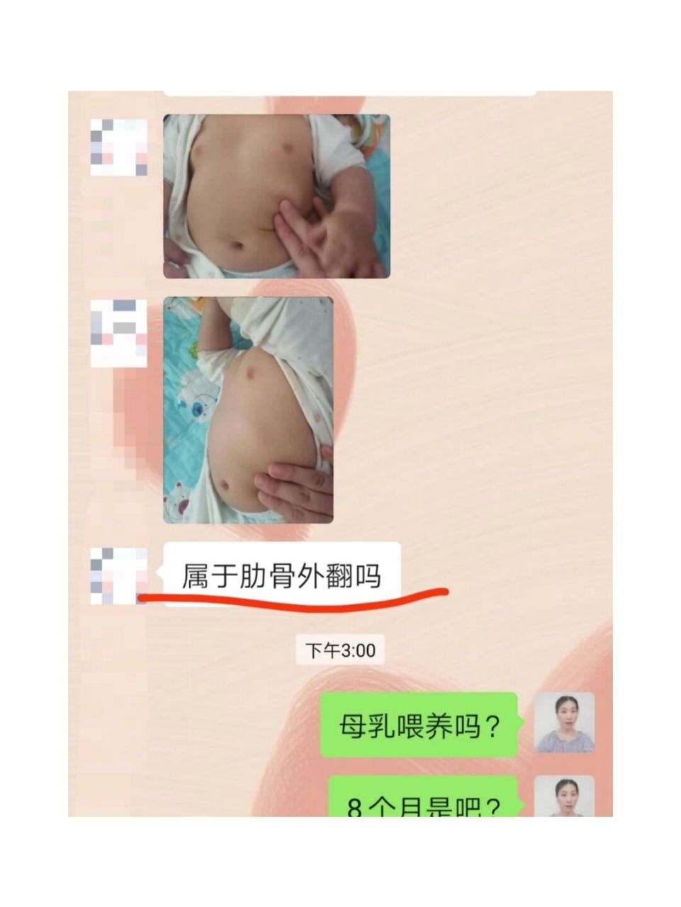 肋骨外翻图片 腹肌图片