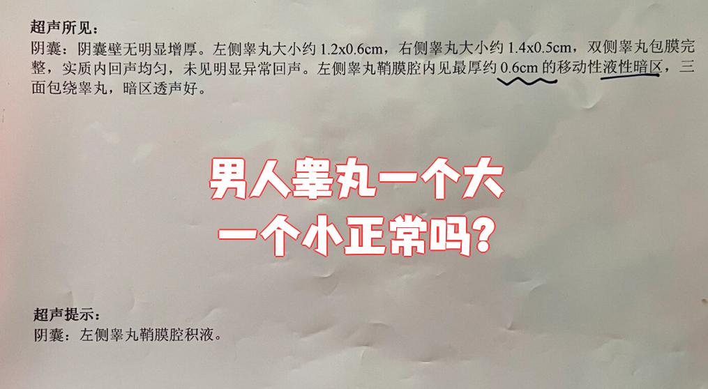 男人蛋蛋为什么一个大一个小