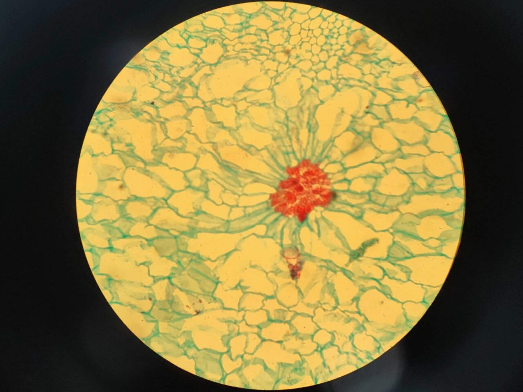梨果实切片示石细胞 植物学实验