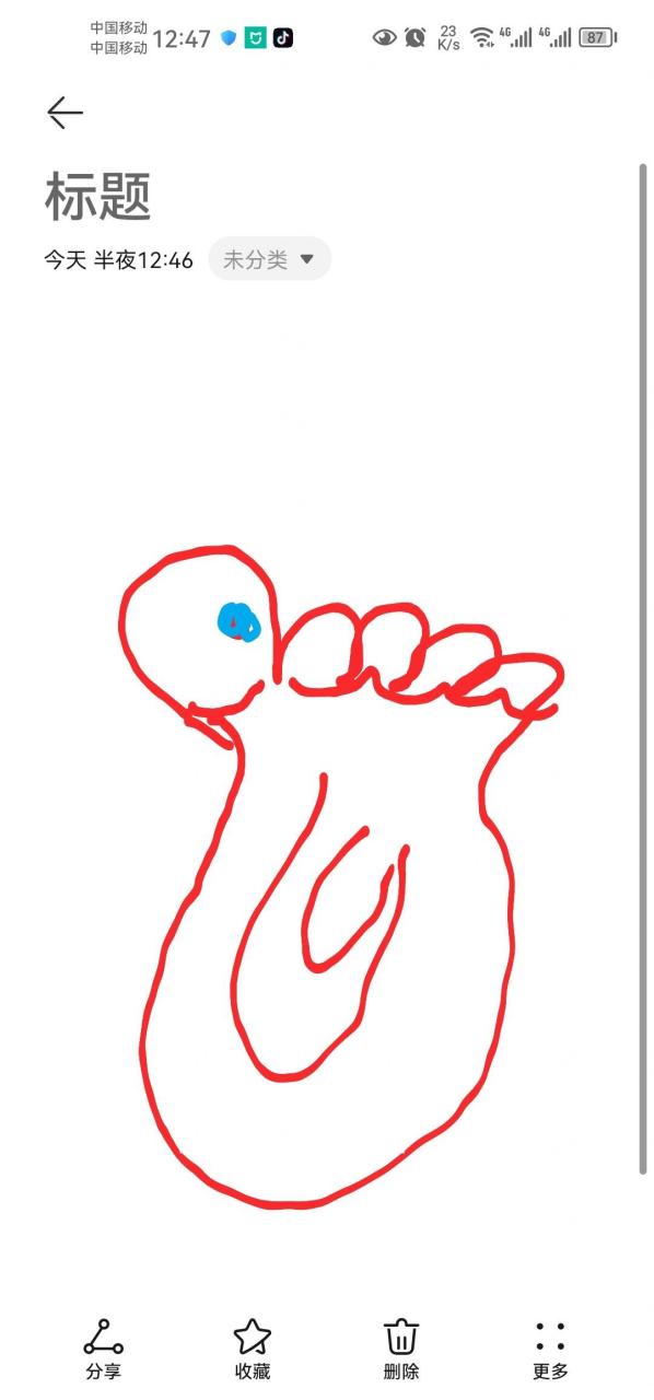 刚开始痛一下 大半夜被大脚趾头底下表皮像针扎的地方刺醒是怎么回事?