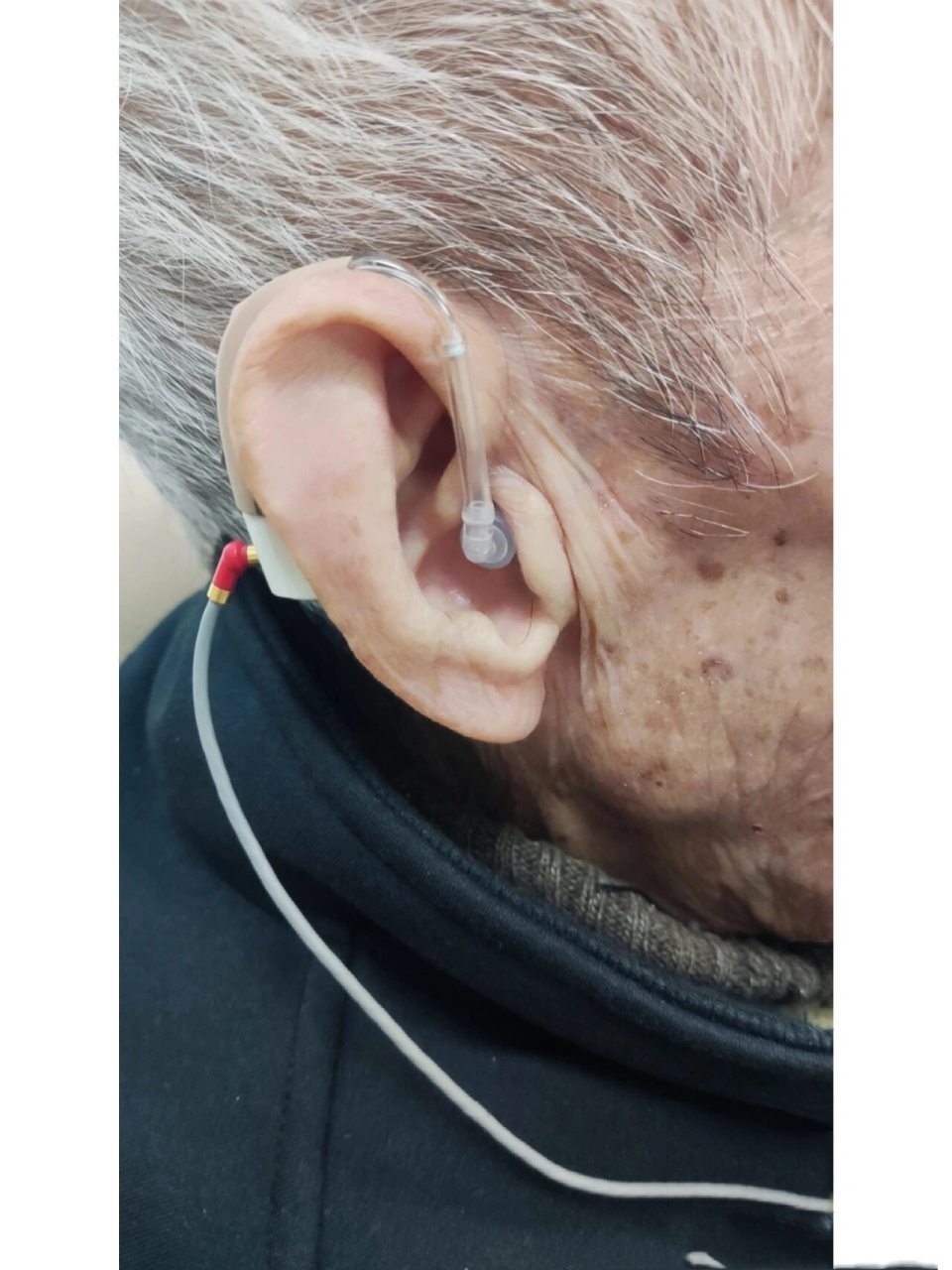 老年性耳聋一般是由于听觉系统衰老,遗传因素,心血管疾病,耳毒性因素