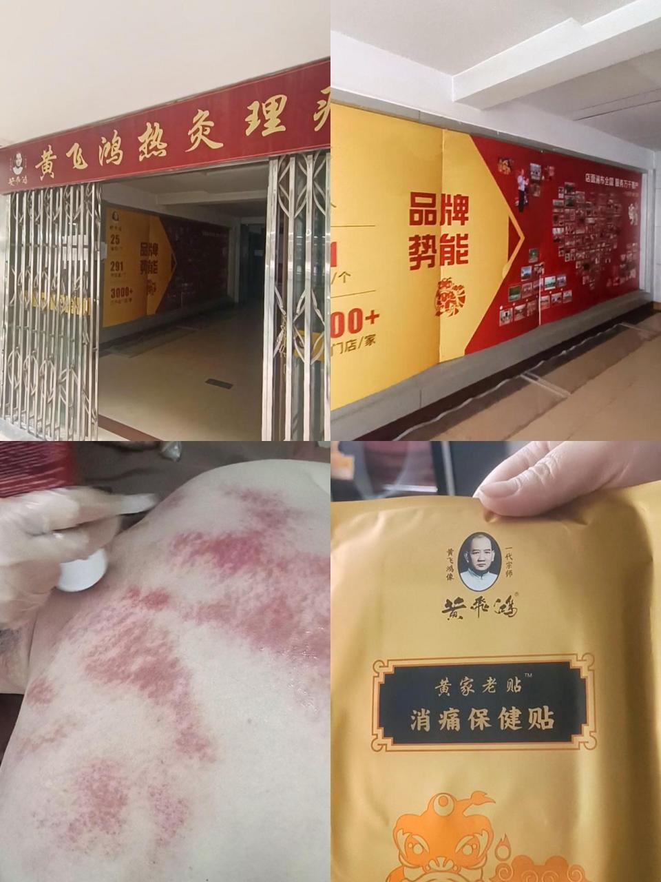 现场实拍 优惠活动火爆进行中 心动五一 黄飞鸿热灸理疗馆 养生就是养