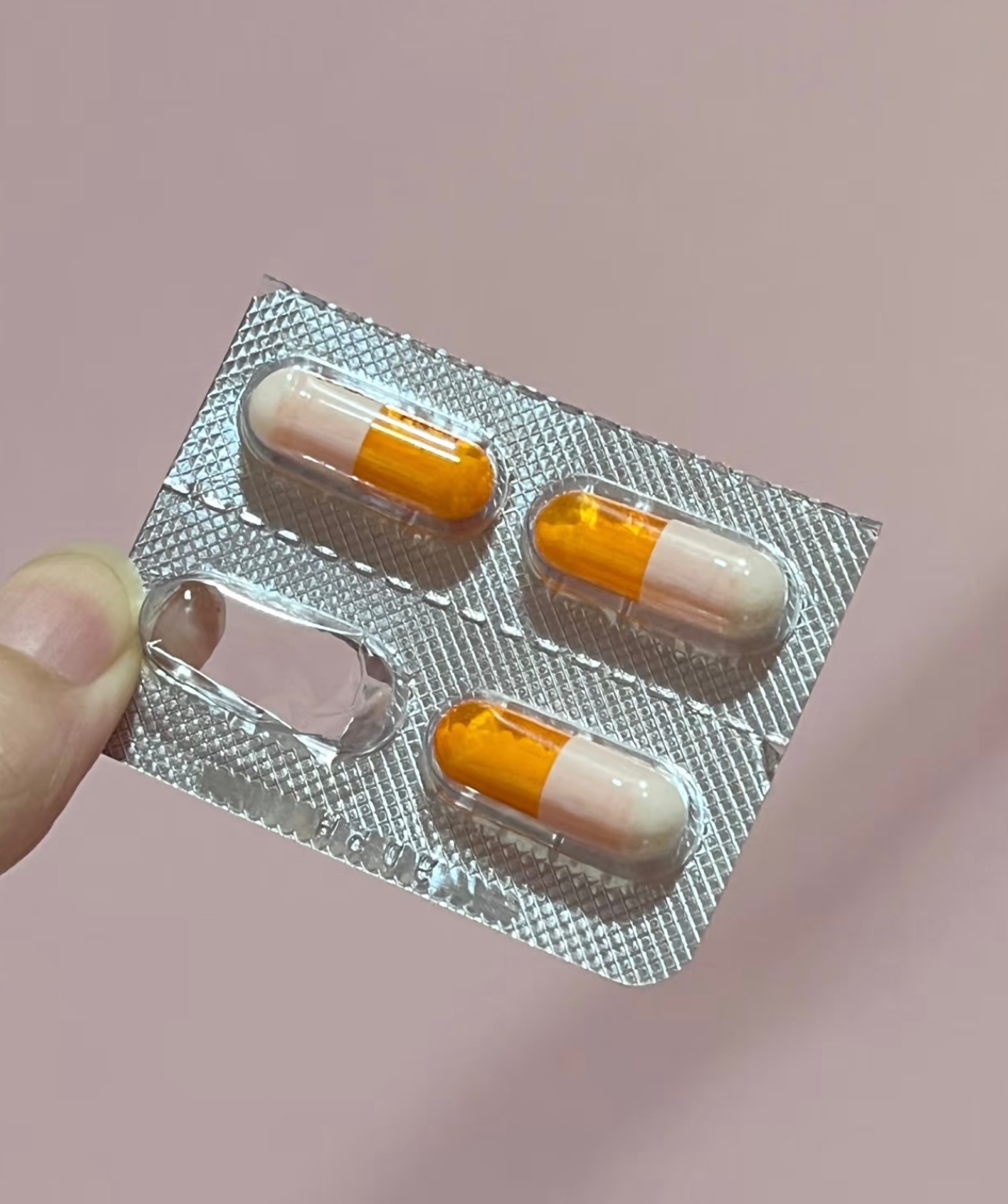 左侧臀部骨头疼可能由多种原因引起