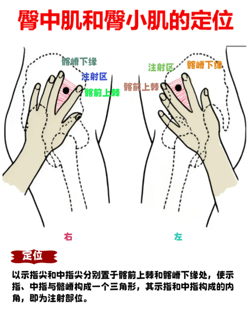 打针为什么打在臀部