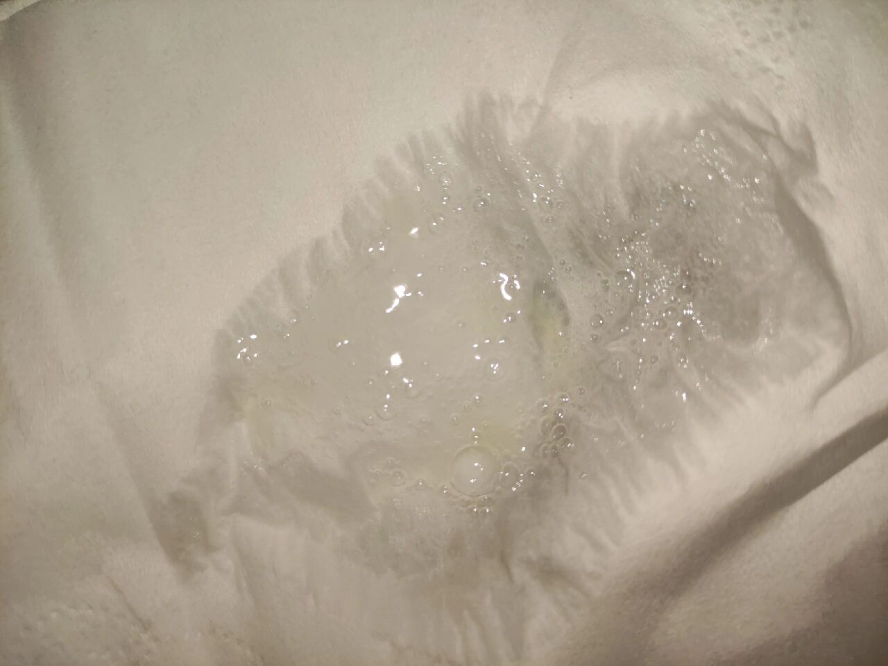 咳嗽一直不断,这几天逐渐加重,喉咙异物感,一直拔痰,白色泡泡痰,有