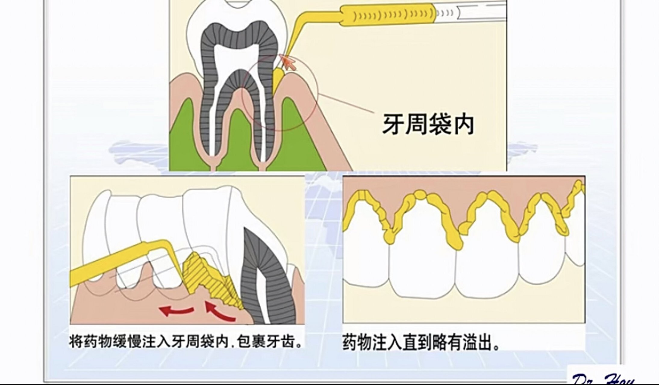 派力奥牙药说明书图片