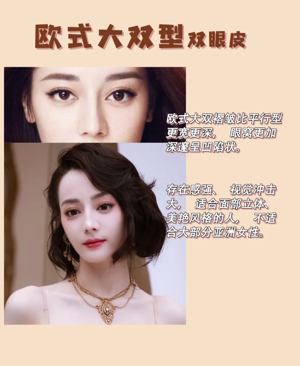 新月型 双眼皮最宽褶皱在眼中,两端靠外轻微内眦,整体呈月牙形 适合