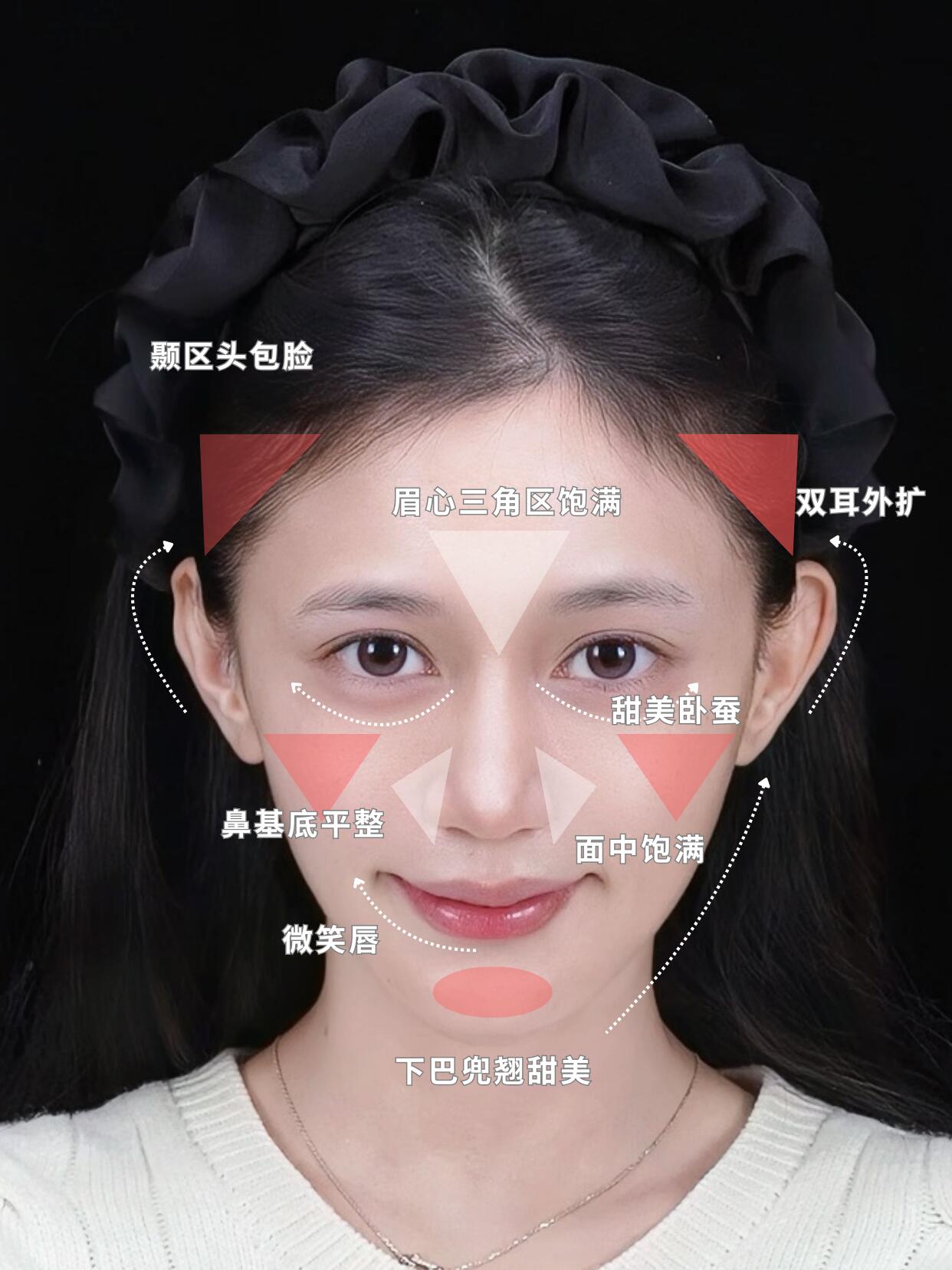 2.  太阳穴:饱满太阳穴可平衡面部比例,建议用胶原蛋白填充