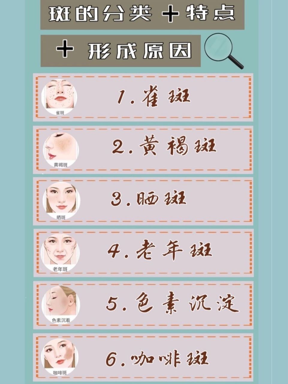 99怎样区分斑的种类,斑的特点和形成原因 一,斑的分类 1.