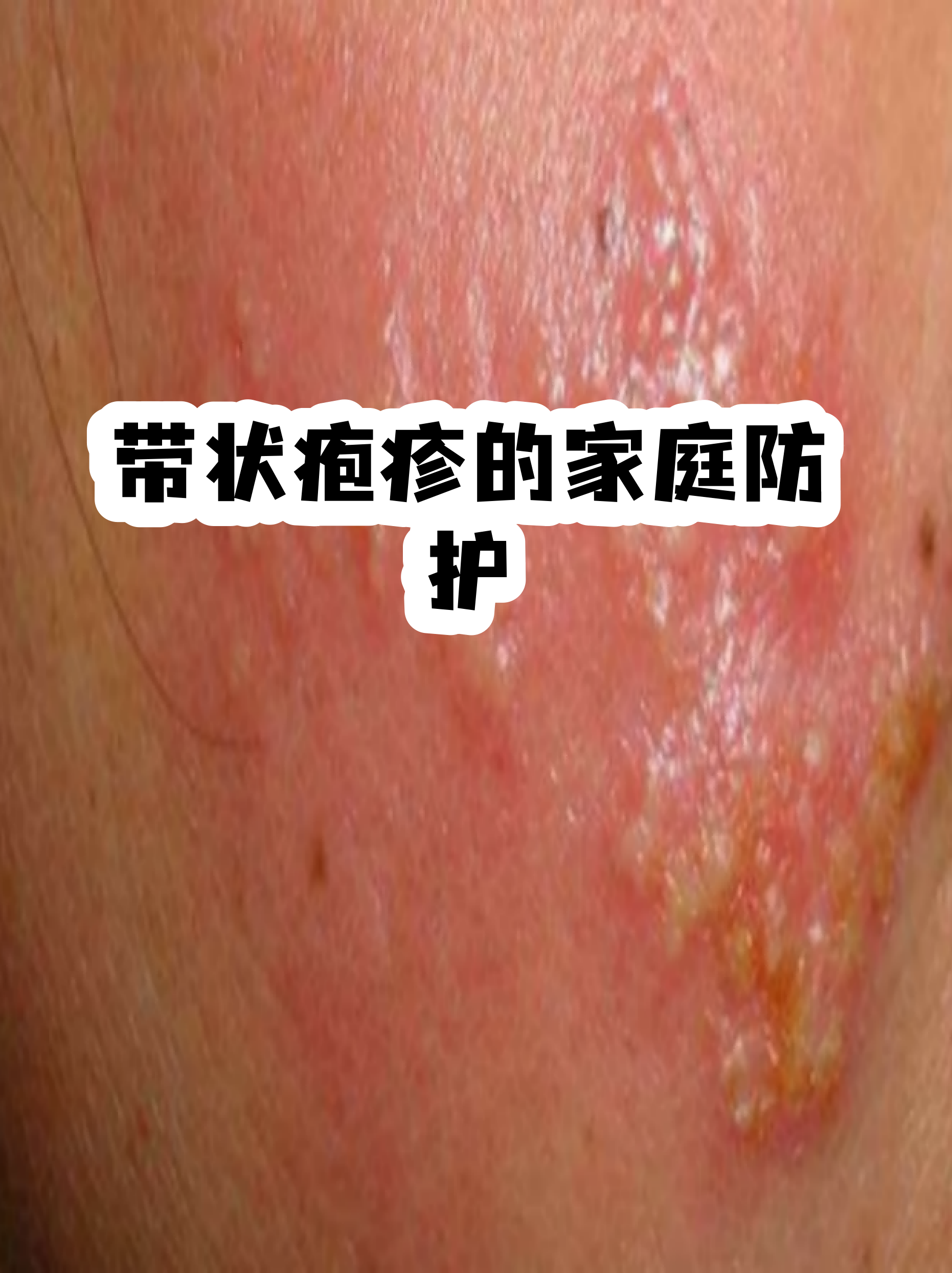  最近流行病毒什么病什么症状都没有(中国又出现一种新病毒)