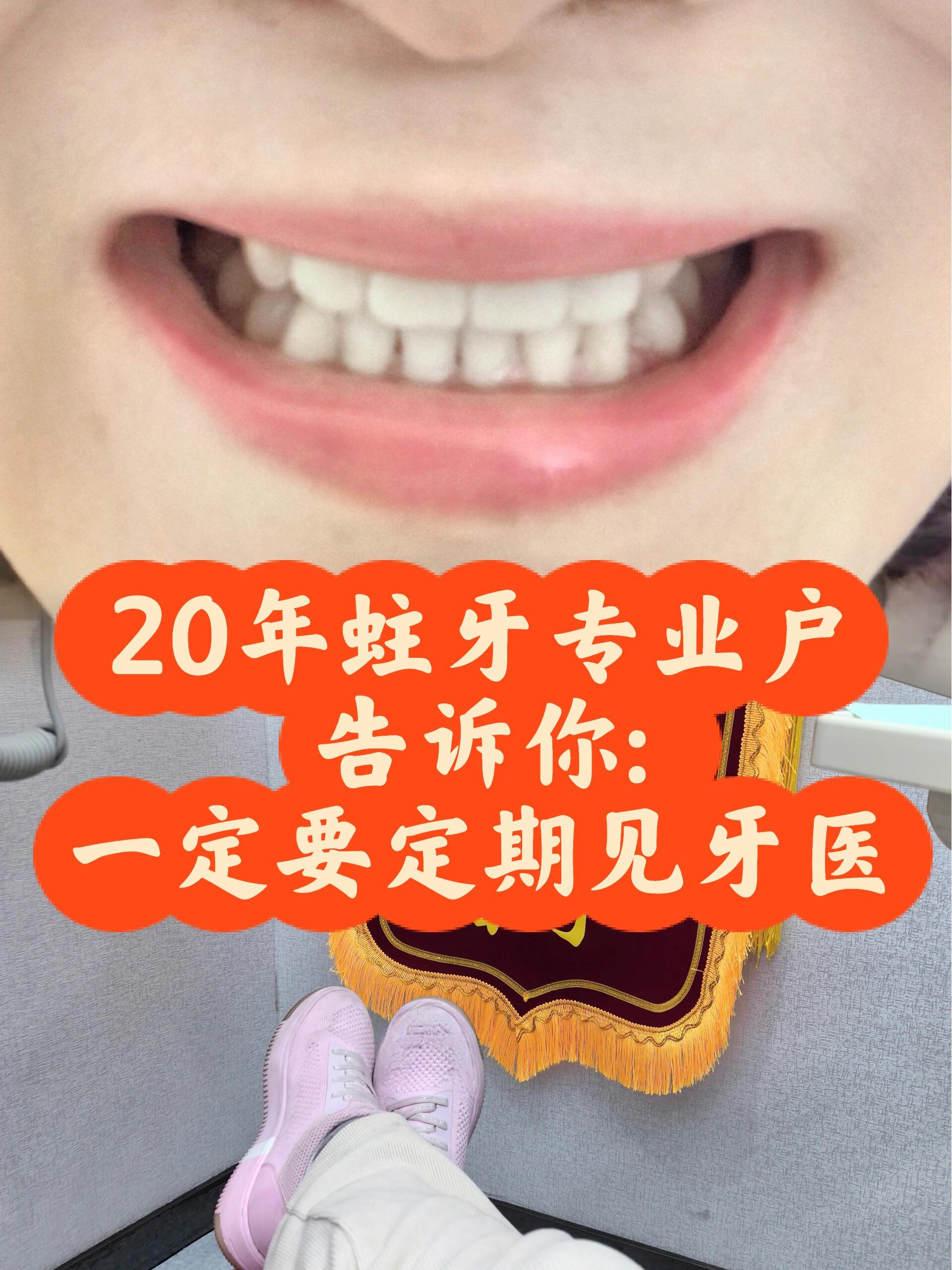 拜拜了,服役10年的全瓷牙 我的四颗全瓷牙套,是2014年装的,半年前觉得