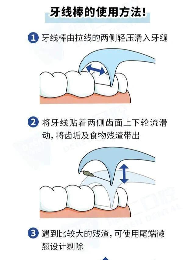 用牙线牙缝会不会变大图片