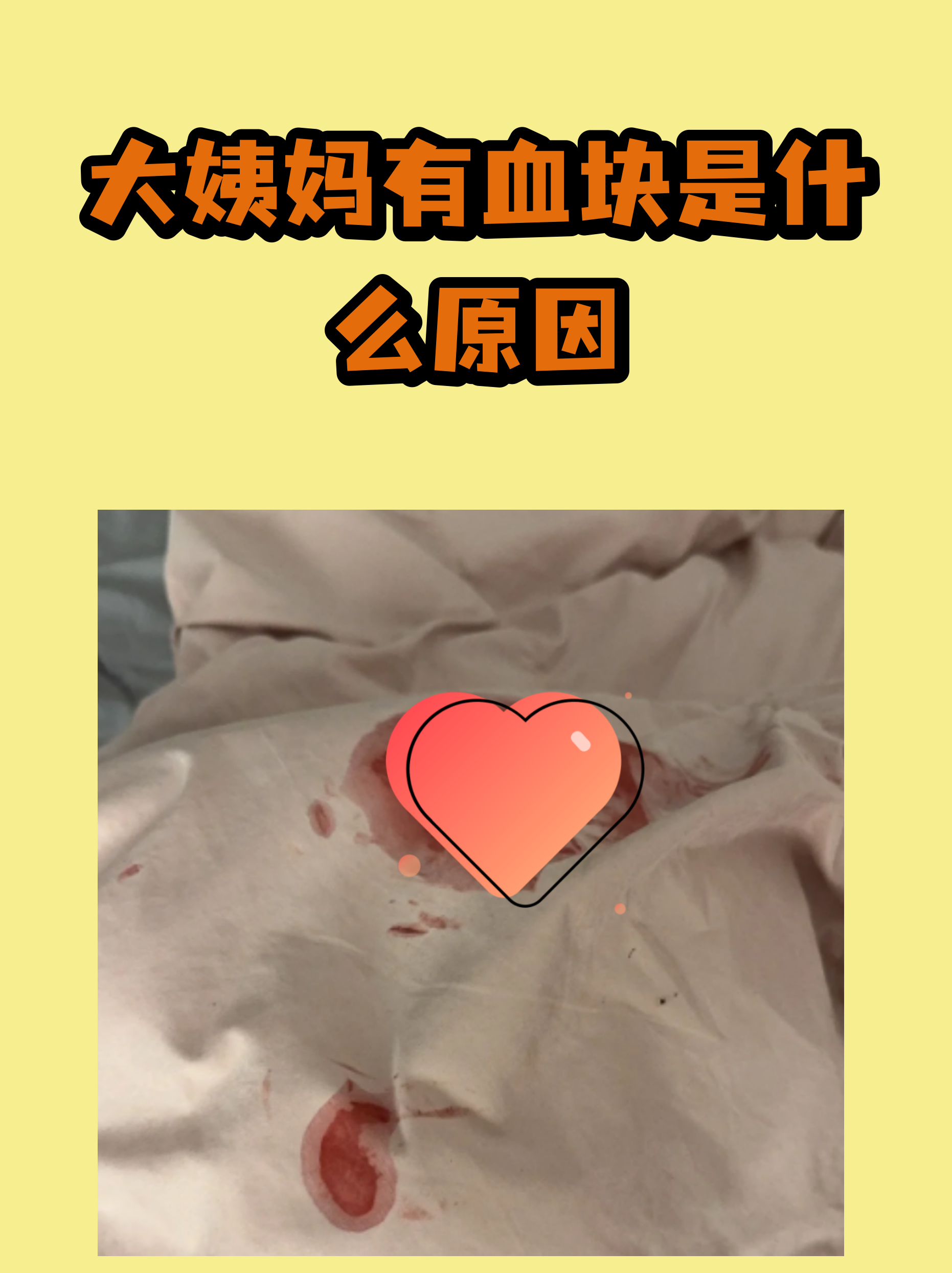 血块图片(流产血块图片)
