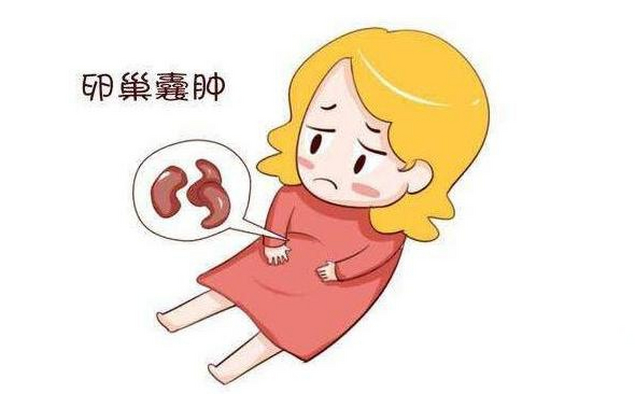 卵巢囊肿,必须开刀吗?