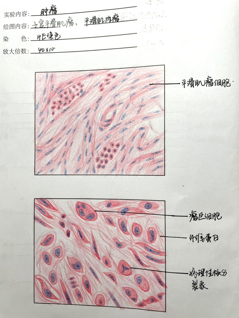 平滑肌纵切图图片