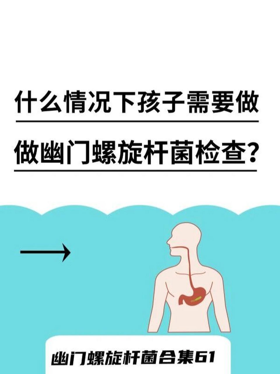 什么情况下孩子需要做幽门螺旋杆菌检查? 幽门螺旋杆菌感染不可忽视!