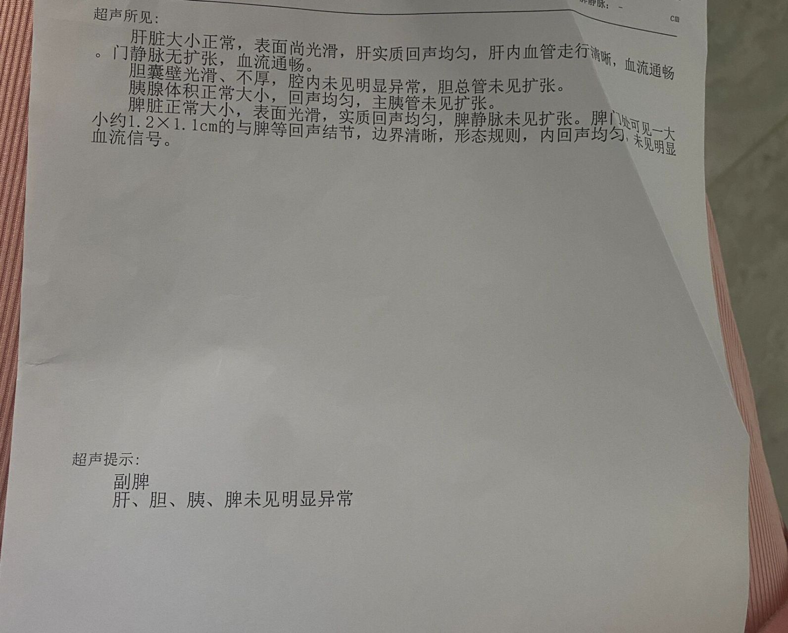 竟然还有个副脾,我就去各种搜 说是发生率百分之30以内,但也正常 还