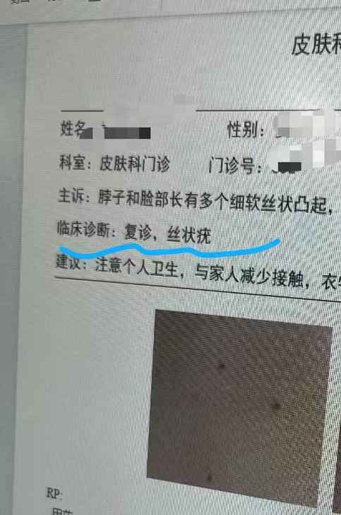 为什么会长肉粒猴子为什么在线