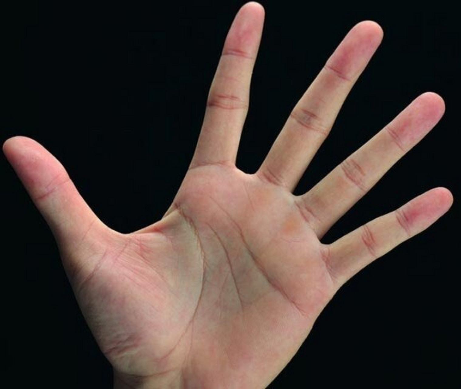 哪些手纹代表婚姻不利 1,断掌纹 断掌纹就是手上的婚姻线和智慧线重叠