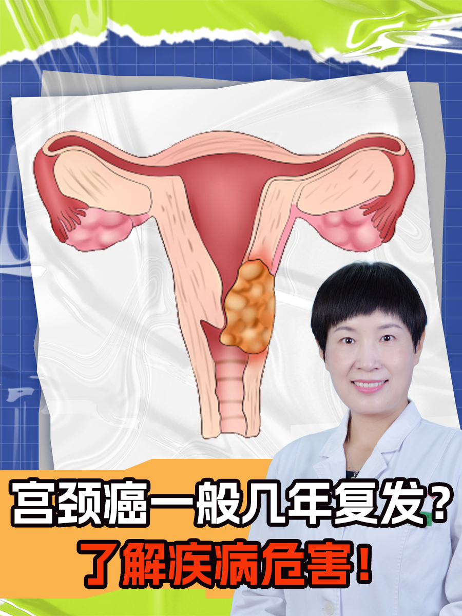 宫颈癌是女性常见的恶性肿瘤之一