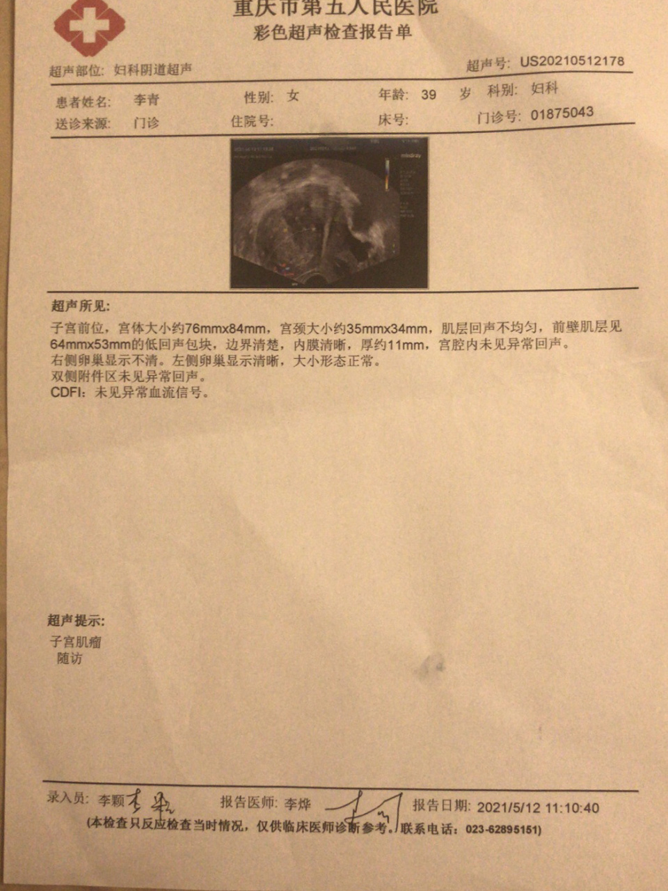 曼月乐环真实记录,希望可以给到姐妺们参考 第一次开帖记录放置曼月乐