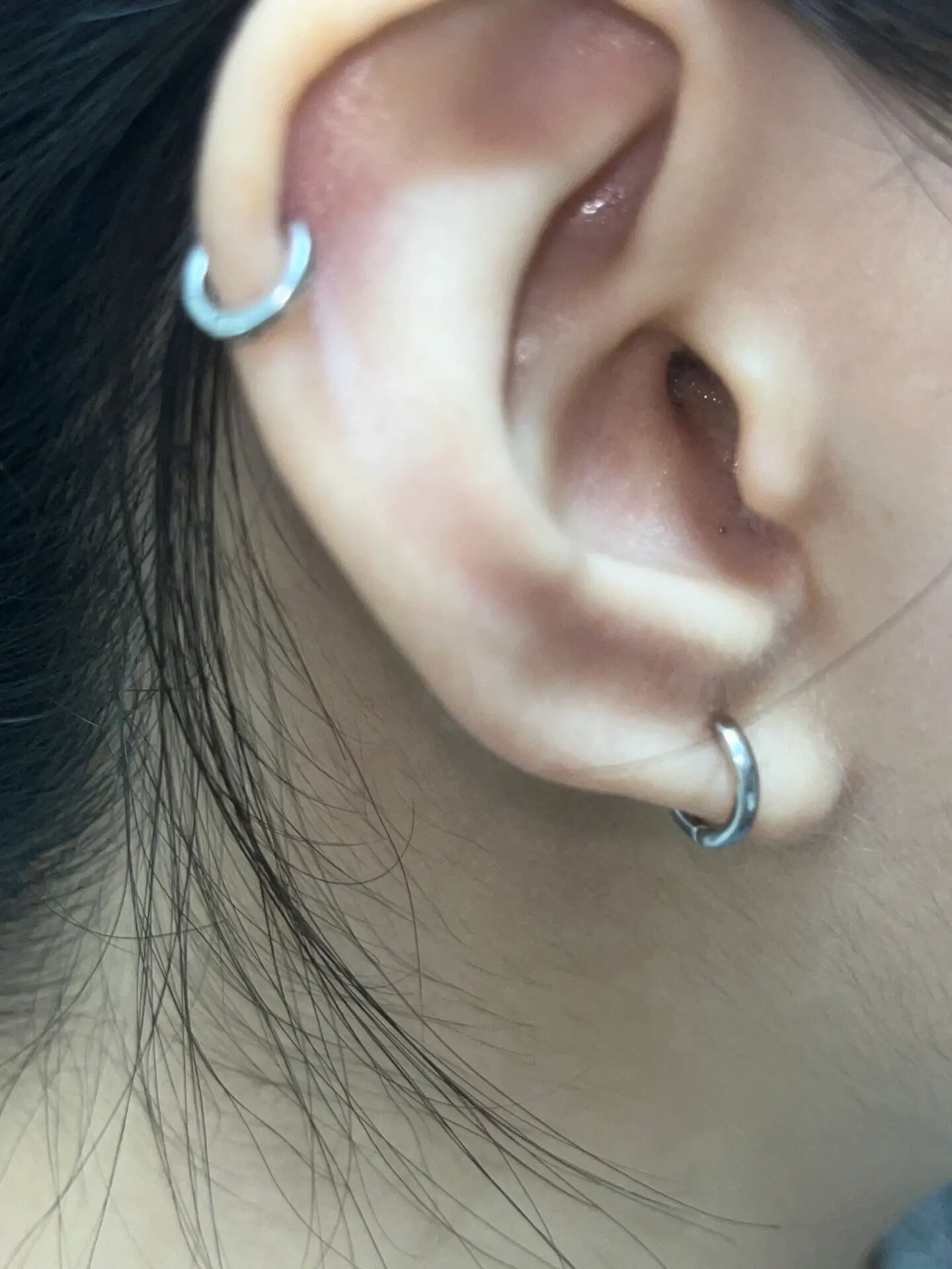 什么?耳朵里的黑头好像我也有00 最近看太多挤耳朵黑头的视频了