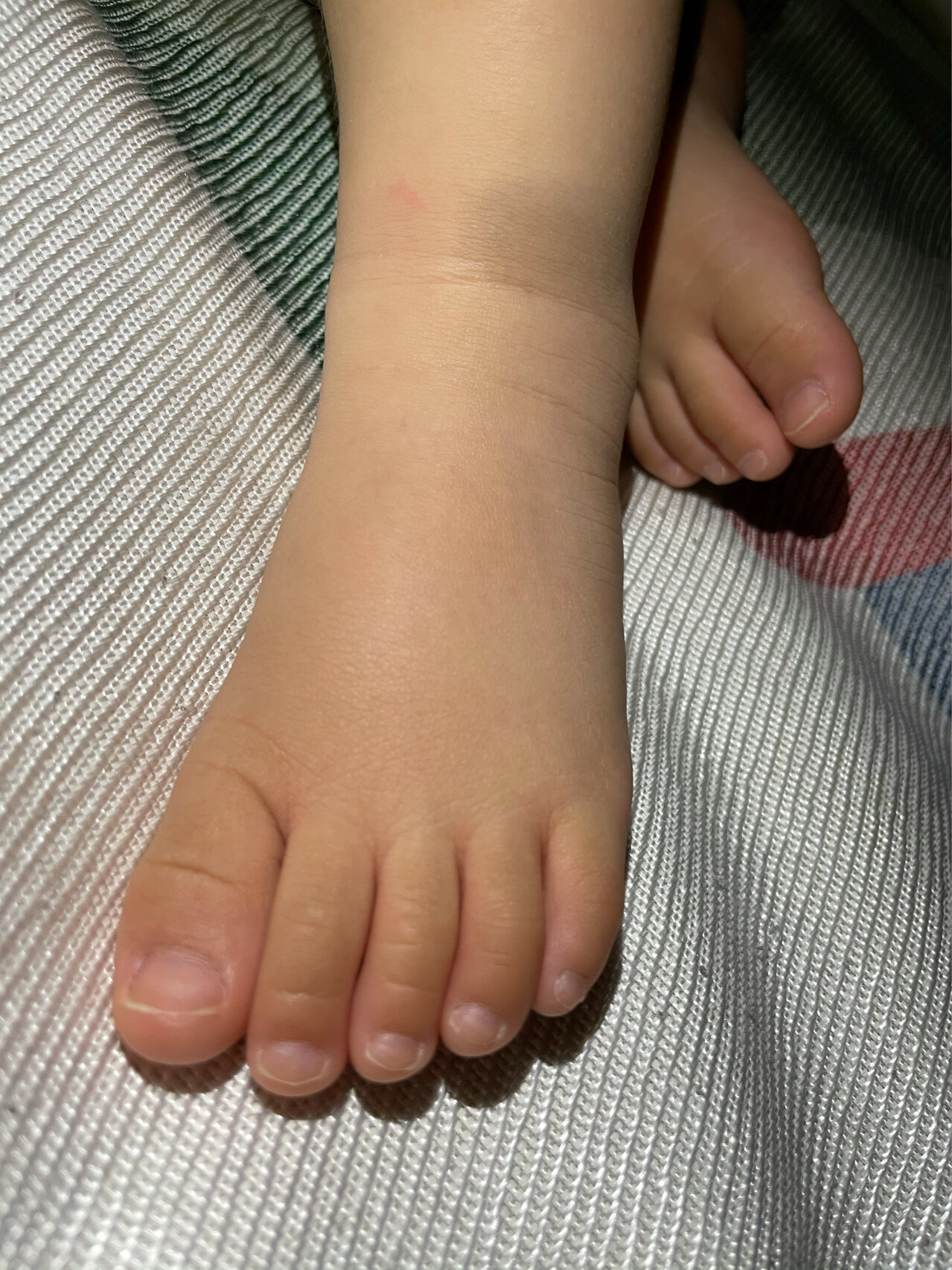 这么嫩滑的小脚丫,长大了也会起厚死皮,磨出茧子,运动磕磕碰碰… 老