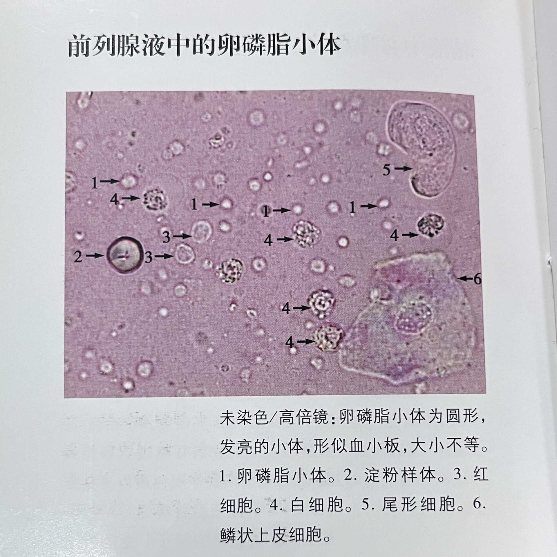 前列腺液白细胞图片